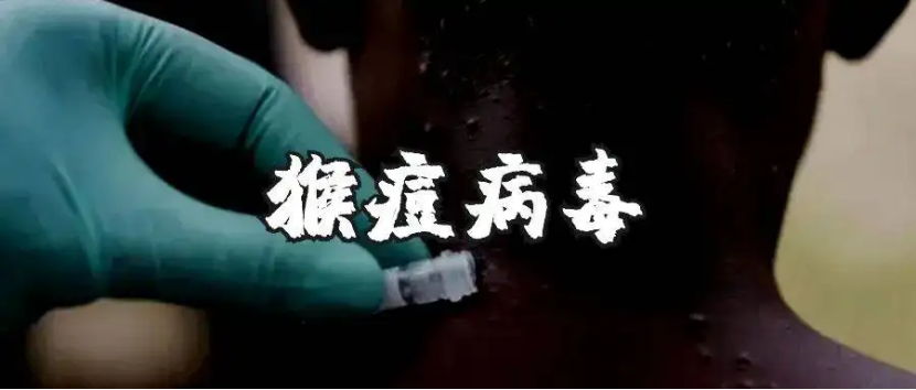 羟丙基倍他环糊精